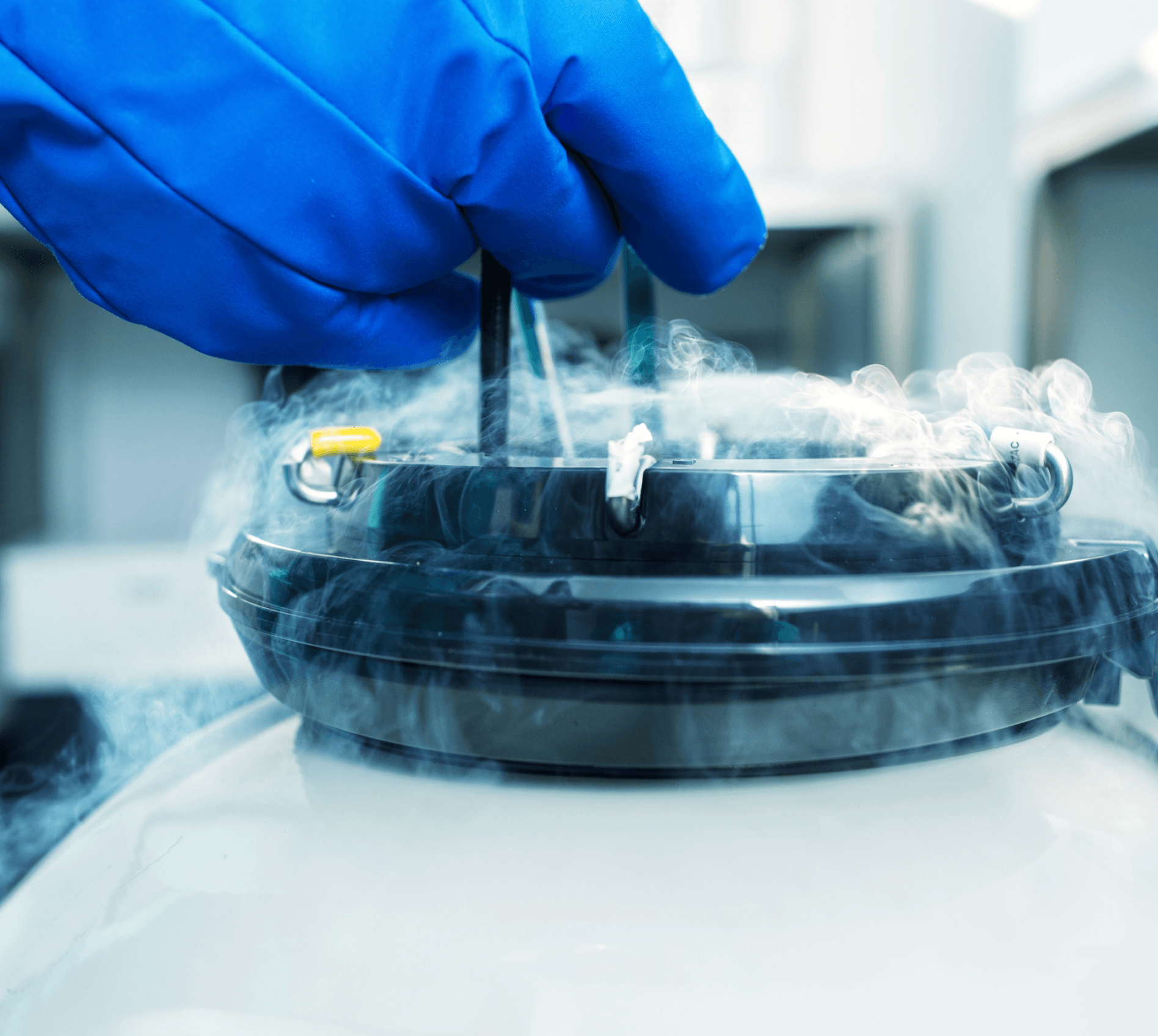 When Should You Freeze Your Eggs? Expert Advice for Women in Their 20s and 30s
