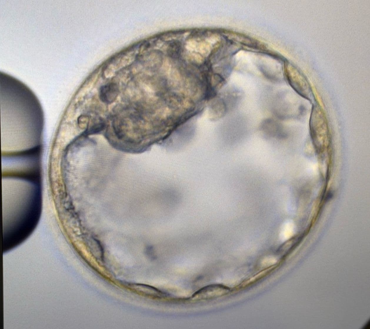 IVF Laboratory Microscope